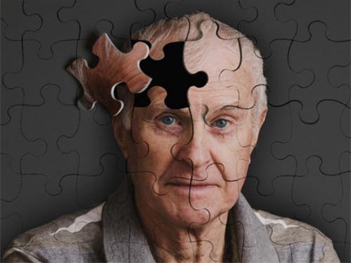 Bệnh Alzheimer là bệnh gì?