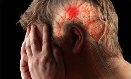 Đau nửa đầu bên trái