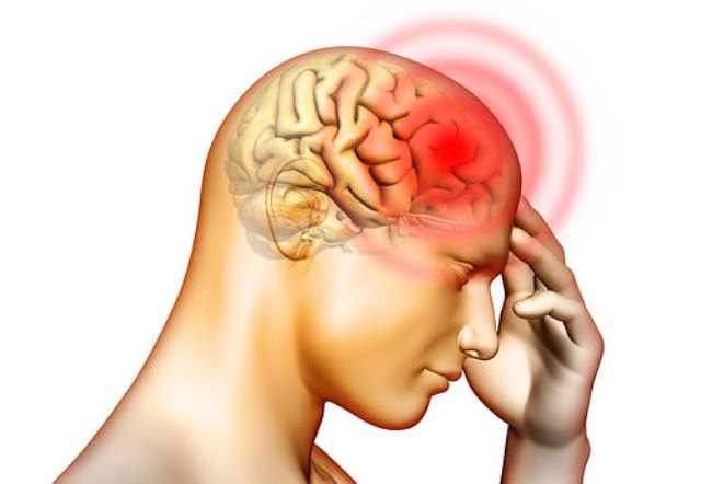 Đau đầu là triệu chứng thiếu máu não phổ biến nhất.