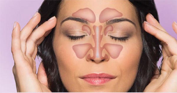 Bệnh viêm xoang là một nguyên nhân gây ra chứng đau đầu