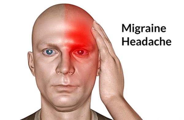 Bệnh đau nửa đầu Migrane