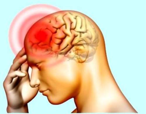Đau đầu vận mạch gây nên những cơn đau đầu dữ dội
