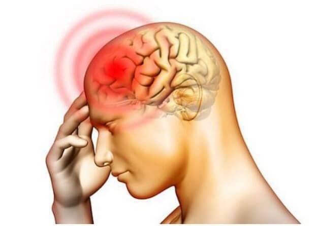 Điều trị thiếu máu não