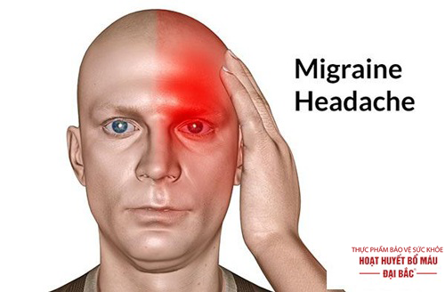 Bệnh đau đầu vân mạch là gì