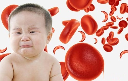 Cách điều trị thiếu máu thiếu sắt ở trẻ em