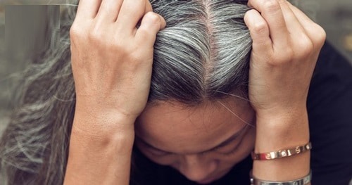 Hiện tượng có tóc bạc sớm là bệnh gì